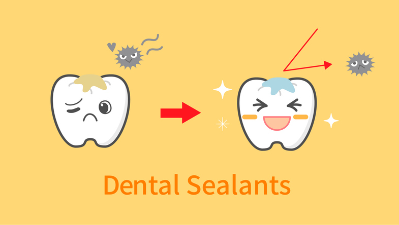 Protecting Tiny Teeth: The Benefits of Dental Sealants for Children